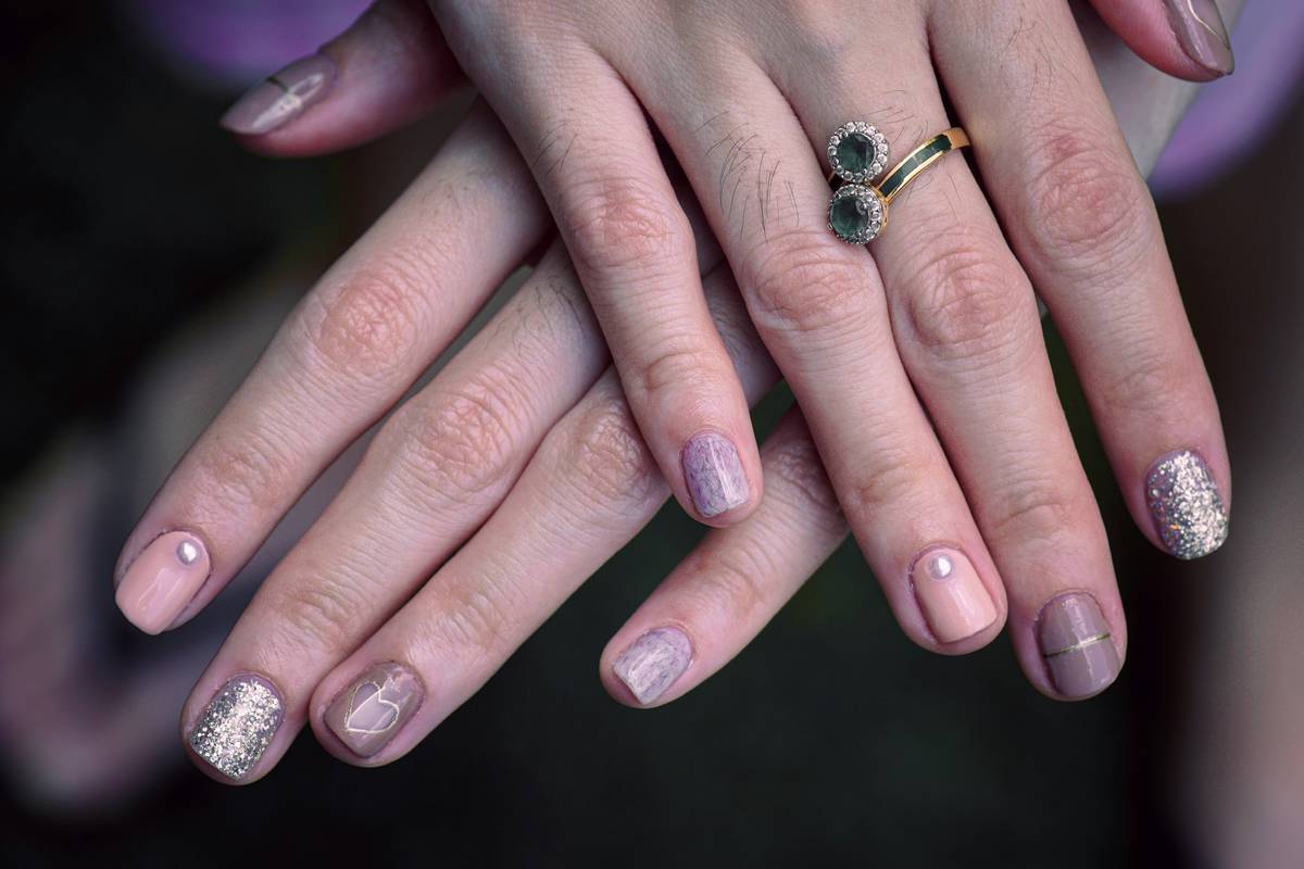 Infographic showing signs of poor nail health: brittleness, white spots, ridges, peeling layers, and discoloration linked to causes like dehydration, nutrient deficiency, over-filing, and fungal infection.